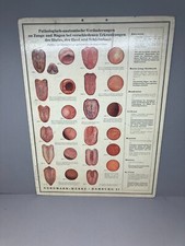 alte Lehrtafel pathologische