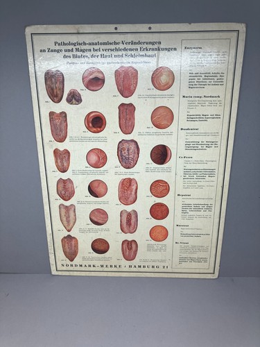 Alte lehrtafel pathologische - alte,